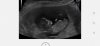 Screenshot_20210406_123030_com.android.gallery3d.jpg