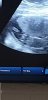 Screenshot_20210430-102219_Video Player.jpg