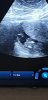 Screenshot_20210430-102509_Video Player.jpg
