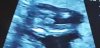 Screenshot_20210505-215820_Video Player.jpg