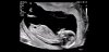 Screenshot_20210513-091103_YouTube.jpg