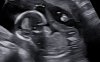 239934426-01.jpeg