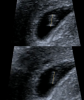 F3075E0A-2269-4360-82AD-EBD042F640BE.png
