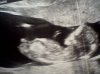 22-04-2013 echofoto kindje 1, 11w6d foto 2.jpg