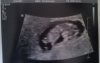 10w6d.jpg