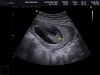 BABY NEDERVEEN_0005.jpg