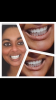 E264D6A1-AFD2-4669-9932-7D76A62FEFFE.png