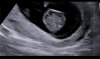 20210615_171720.jpg