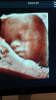 9A0409EA-9D95-4280-8C2E-778625FE45E9.png