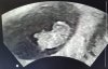 received_1677063399170386.jpeg