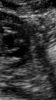 E73FC2E0-E1E5-4A41-90FF-D269DA2BF0B9.png