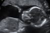 Screenshot_20210811-195221.png