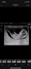 D414A535-AEEA-41C2-AE19-B67AC324F8AE.png