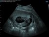 WENDY.H_0006.JPG