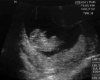 Echo 20120607.jpg