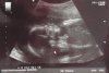 20w6d.jpg