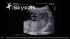 baby.jpg