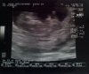 Echo 10w6d.jpg