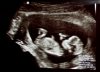 baby12weeks5days.jpg
