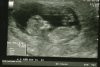 nub 12wk.jpg