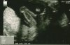 nub 18wk.jpg