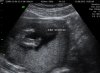 BABY_10.jpg