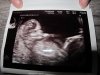foto 1 baby.JPG