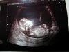 baby 3.jpg