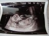 baby 4.jpg