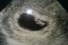 IMAG0095.jpg