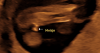 download-14.png
