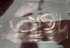 0B227BD8-FC54-47E0-A6C1-C8DEB30E6E1D.jpeg