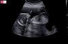 B06AC4D3-BEBE-46C8-BE63-93BFBEDD3333.jpeg