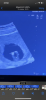 A0E37A73-27F0-45E3-BE13-2A18508F43E8.png