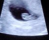 VideoCapture_20211125-113533.jpg