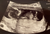 upload_2021-12-10_10-0-1.png