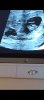 Screenshot_20211221-141825_Gallery.jpg