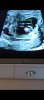 Screenshot_20211221-141833_Gallery.jpg