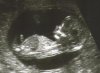Ultrasound1.jpg