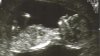 Ultrasound2.jpg