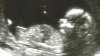 Ultrasound3.jpg