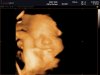 BABY FOTO'S_0001.jpg