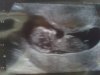 baby koopmans 12 weken echo 007.jpg
