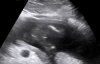 20211228_072549.jpg