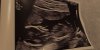 22CA242D-75AA-4C57-89BA-119CB908B812.jpeg