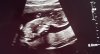 IMG-20220118-WA0009.jpeg