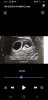 Screenshot_20220118-201026_Video Player.jpg