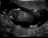 VideoCapture_20220118-200340.jpg