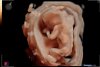 Visser_Gaya_van_der_Helm_baby_202201180026.jpg