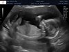 Visser_Gaya_van_der_Helm_baby_202201180015.jpg